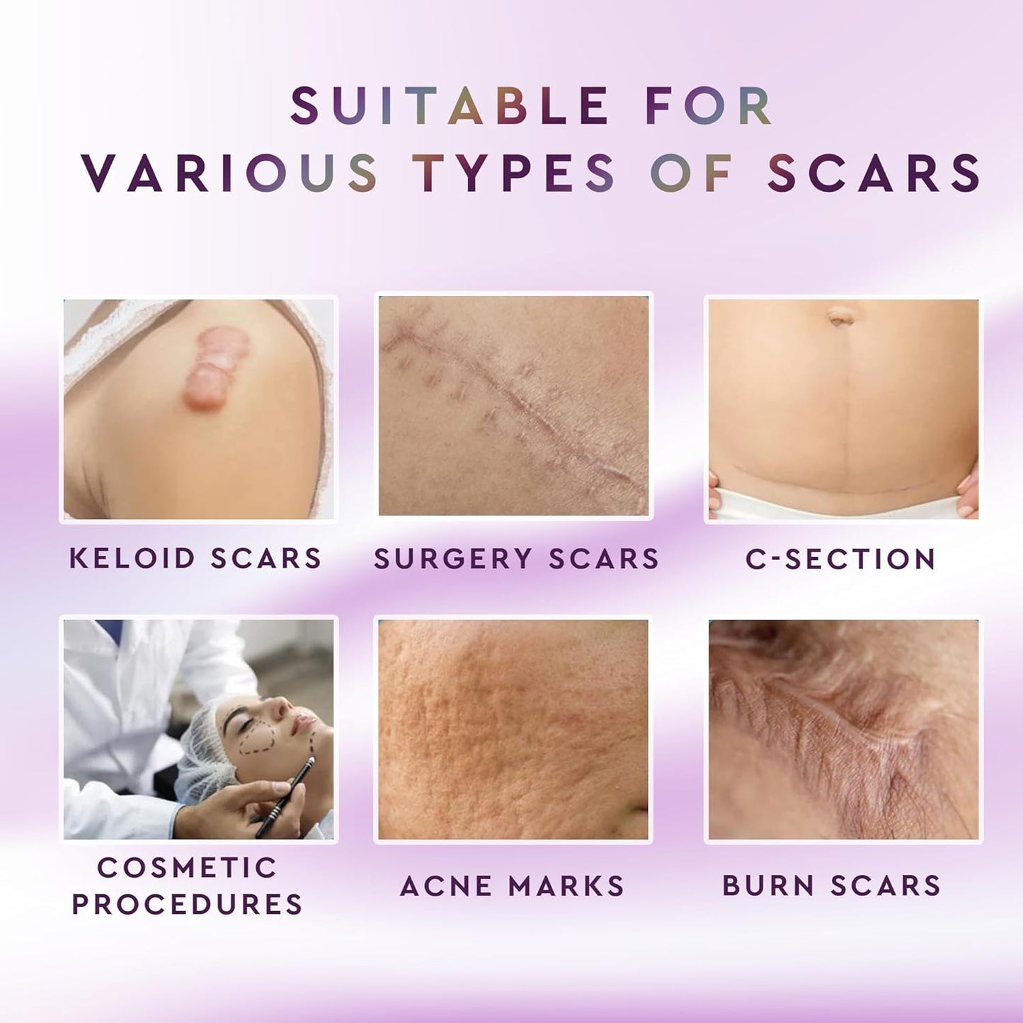 Advanced Silicone Scar Sheets - Post-Surgery Scar Treatment