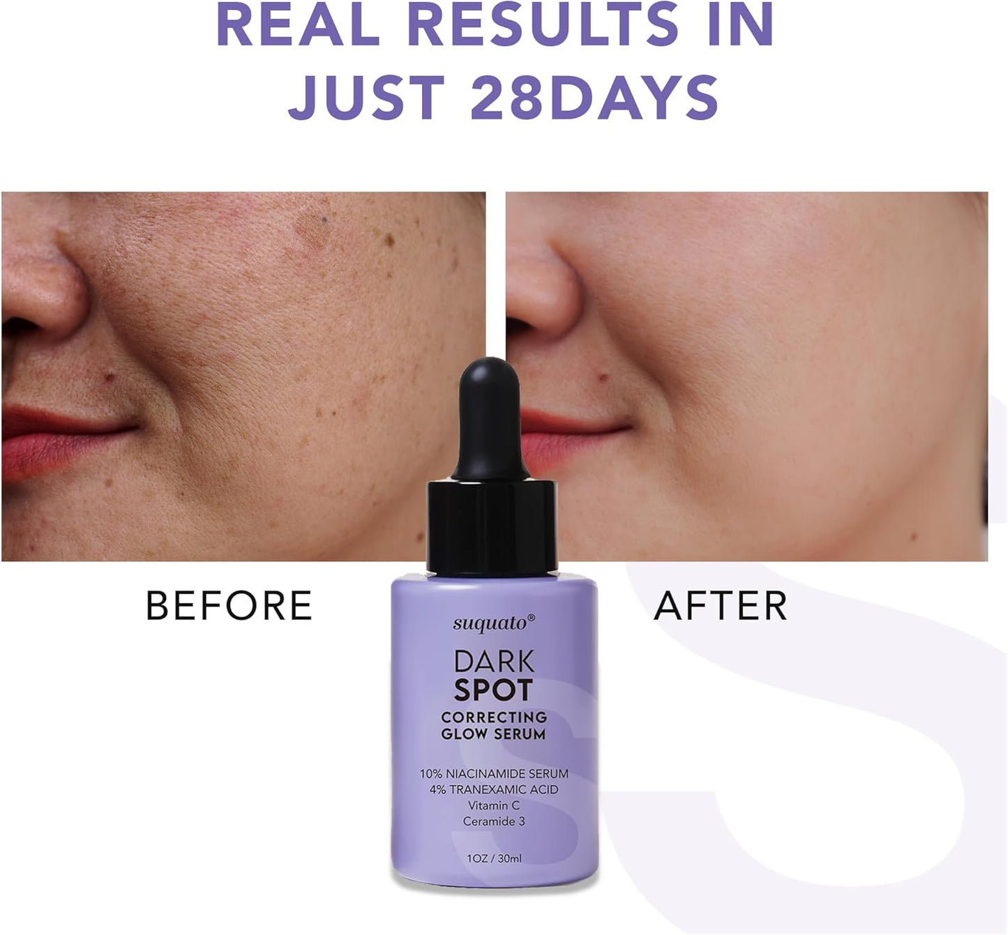Dark Spot Correcting Serum for Hyperpigmentation