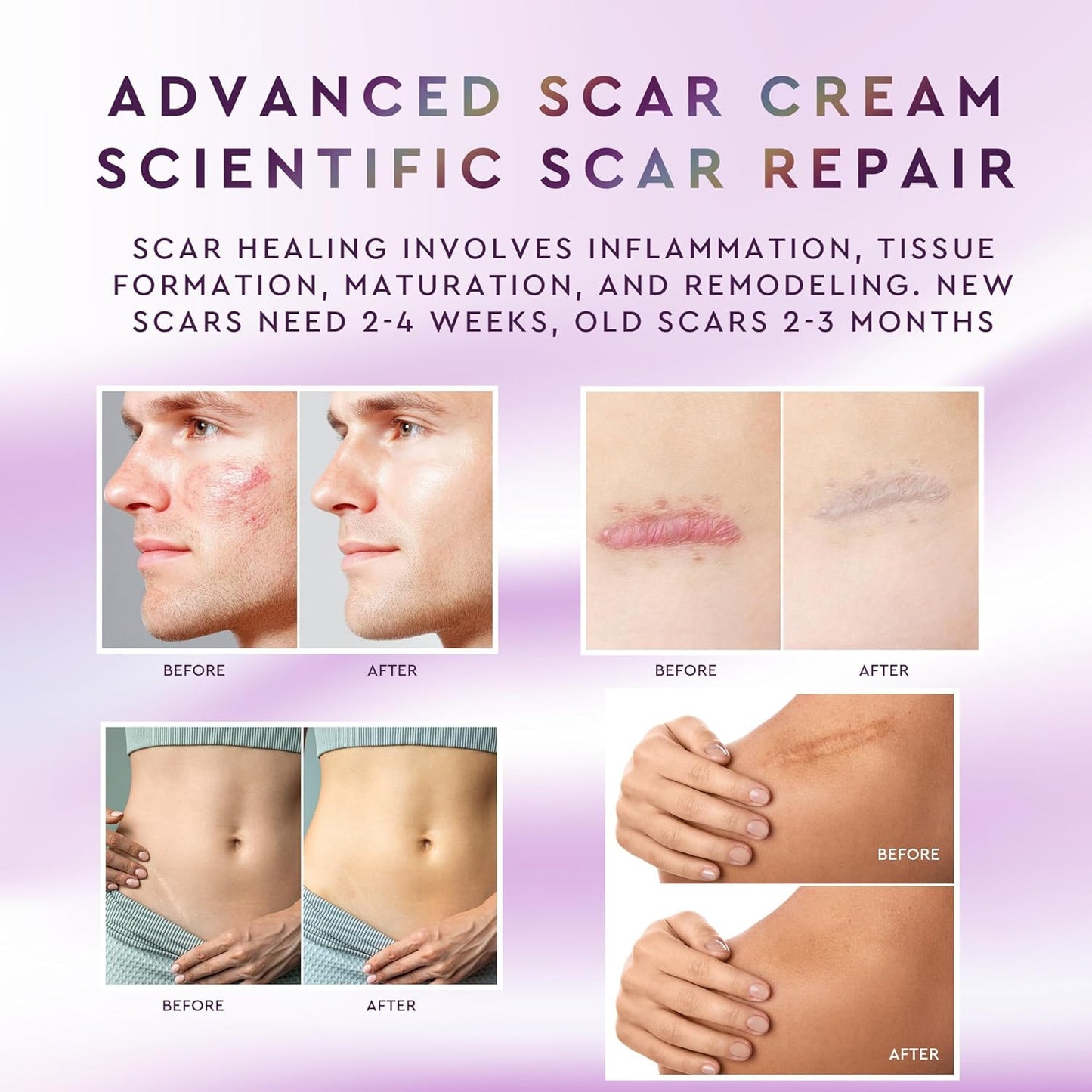 Advanced Silicone Scar Sheets - Post-Surgery Scar Treatment
